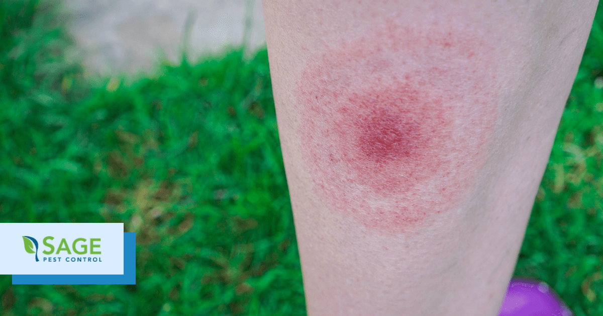 does tick bite itch